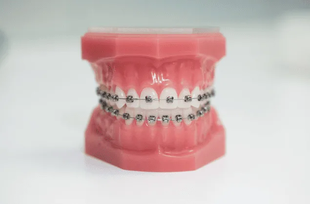 Braces at Diestel Dental Group, Hong Kong