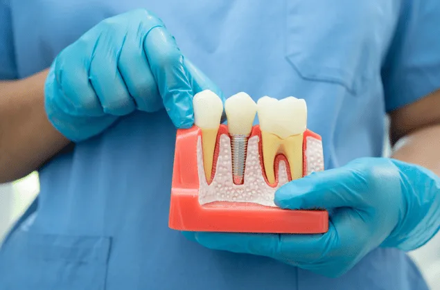 Root Canal Treatment at Diestel Dental Group, Hong Kong