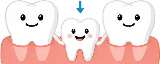 A baby tooth keeping space for the adult tooth that follows