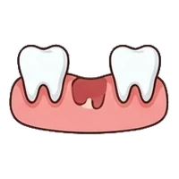 Tooth socket after an extraction