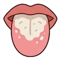 White coating on the back of the tongue