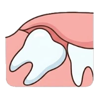 Removing some bone