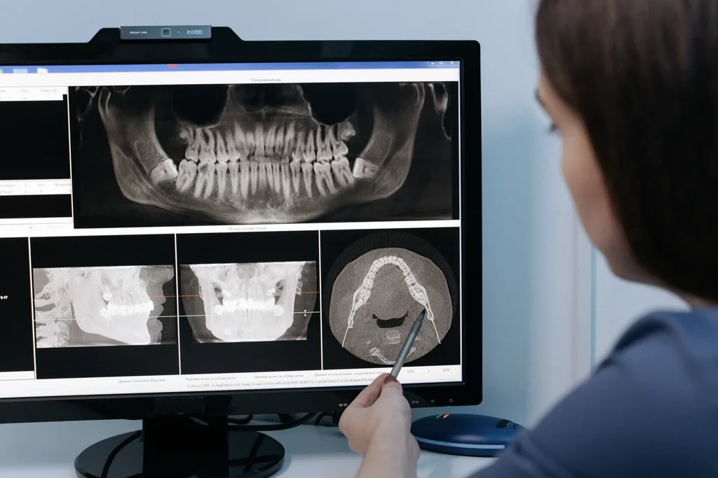 A dentist pointing a pen at a 3D CBCT scan of the lower jaw on a monitor
