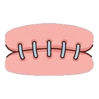 Stitches
