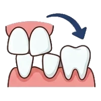 Uneven bite